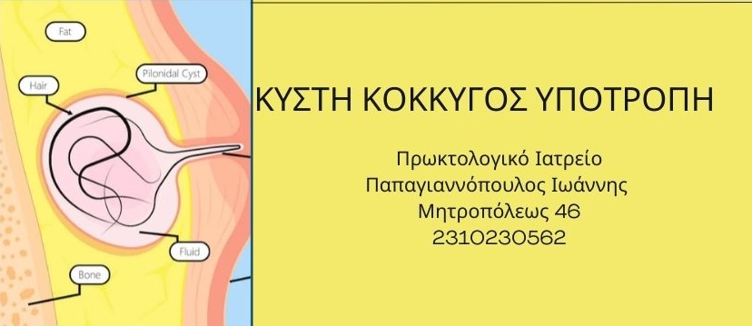 Κύστη κόκκυγος υποτροπή | Πρωκτολόγος Θεσσαλονίκη